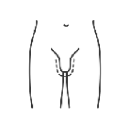 Body lift and Genital Surgery
