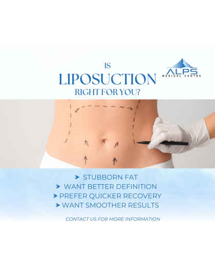 Liposuction